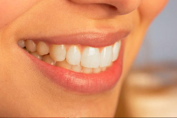 Izbjeljivanje zubi - kako imati zdrave i bijele zube [ ZDRAVLJE ]